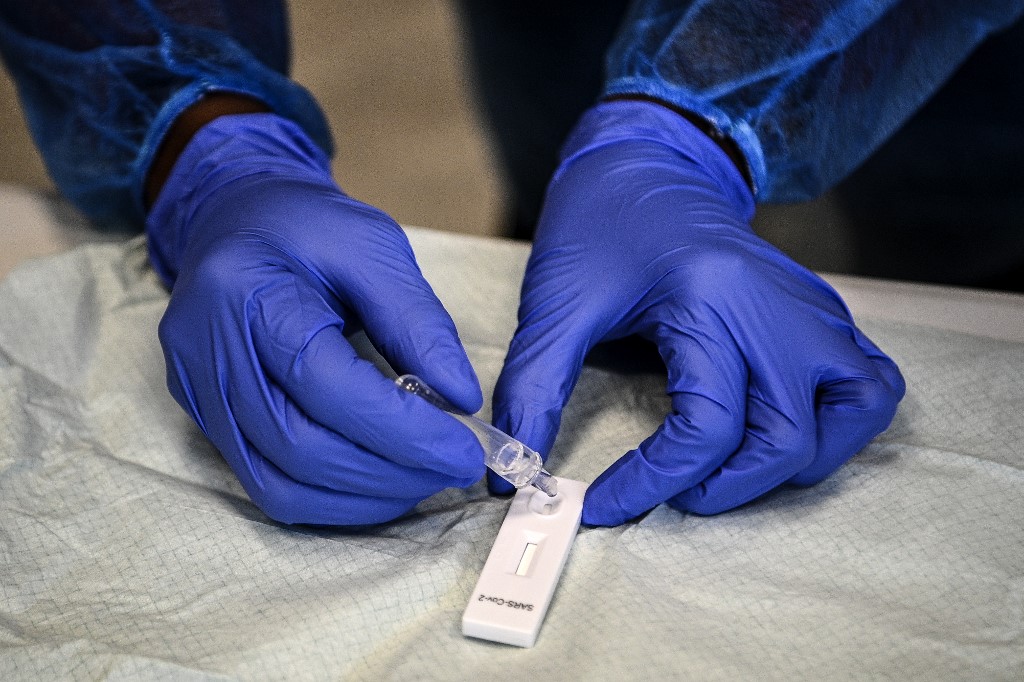 Le prélèvement pour un test antigénique, pour lequel la Haute autorité de santé (HAS) a rendu en octobre un avis « favorable », est effectué dans les narines à l'aide d'un écouvillon, comme les tests dits RT-PCR, qui donnent actuellement les résultats les plus performants.(AFP)