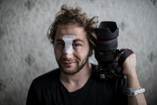 Ouverture d'une enquête pour le photographe syrien blessé samedi à Paris