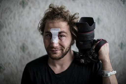 Ouverture d'une enquête pour le photographe syrien blessé samedi à Paris