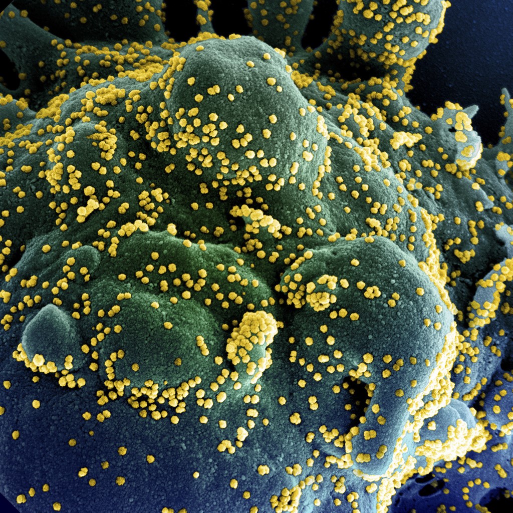 Résultats encourageants pour les medicaments anti Covid-19 de Lilly et Regeneron
