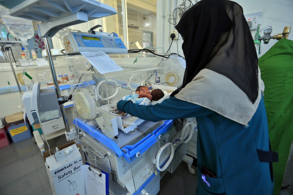 Yémen: des bébés siamois dans un état critique évacués en Jordanie
