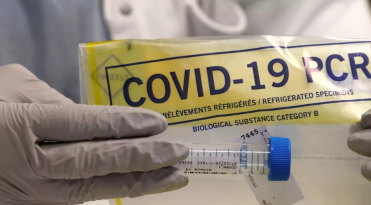 Test PCR (illustration). (LUDOVIC MARIN / AFP)