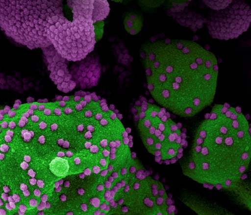 Micrographie électronique à balayage colorisée d'une cellule apoptotique (verte) fortement infectée par le virus du nouveau coronavirus SARS-CoV-2 (violet). (Document à distribuer / Institut national des allergies et des maladies infectieuses/AFP)