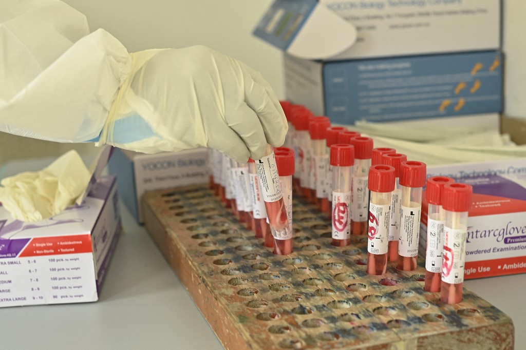 Covid-19: essais encourageants pour un vaccin innovant