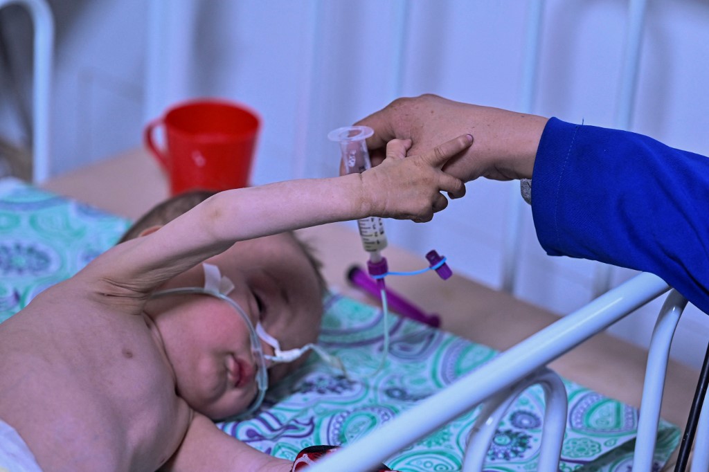 Selon l'Unicef, 3,2 millions d'enfants afghans de moins de 5 ans vont souffrir de malnutrition sévère cet hiver, et un million d'entre eux pourraient en mourir faute de traitements. (Photo/AFP)
