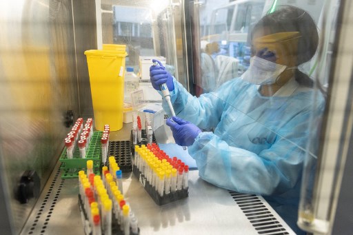 Des chercheurs identifient un virus comme l'origine de la sclérose en plaques