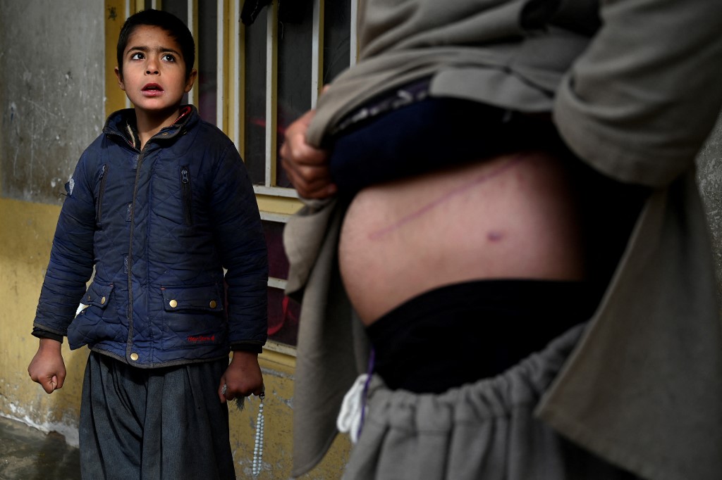 Nooruddin, qui a vendu son rein pour financer sa famille, montre les cicatrices de l'opération aux côtés de son fils Javid, dans leur maison à Hérat, en Afghanistan. (AFP).