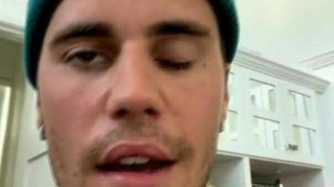 "Je ne suis pas physiquement capable de faire ces émissions", a déclaré le chanteur pop de 28 ans Justin Bieber à ses fans dans une vidéo publiée sur Instagram. (AFP)