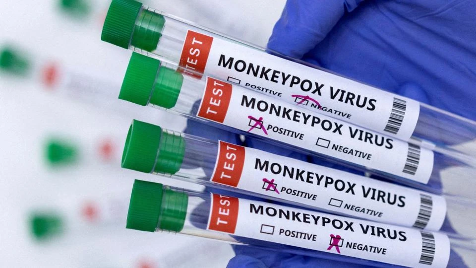 UE: première livraison à l'Espagne de vaccins contre la variole du singe