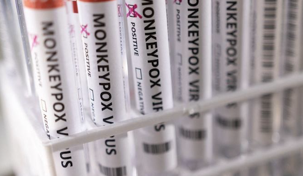 La variole du singe est une maladie infectieuse généralement due à un virus transmis à l'être humain par des animaux infectés. Mais dans la flambée actuelle, la transmission interhumaine est au premier plan (Photo, Reuters)