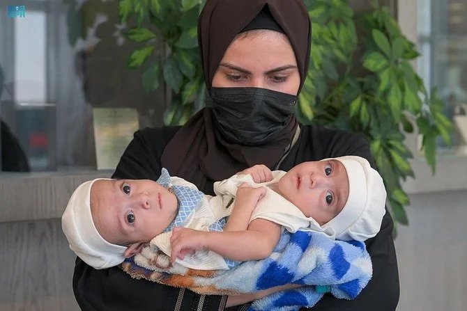 Des frères siamois irakiens arrivent à Riyad dans l'espoir d'une séparation chirurgicale