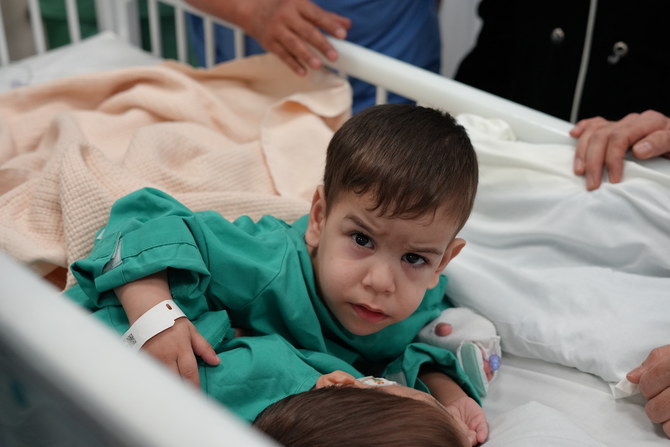 Des chirurgiens saoudiens séparent des jumeaux siamois syriens
