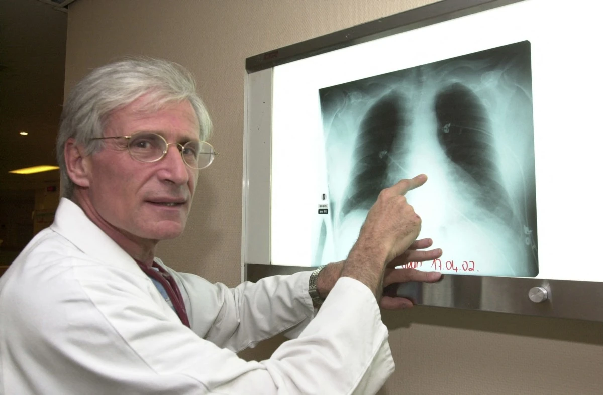 Le professeur français Alain Cribier, chef du service de cardiologie du Centre hospitalier universitaire (CHU) de Rouen, montre une radiographie du thorax d'un patient de 57 ans, sur lequel il a inséré une valve cardiaque artificielle par une veine sans avoir recours à la chirurgie, à Rouen, le 19 avril 2022. (Photo Robert Francois AFP)
