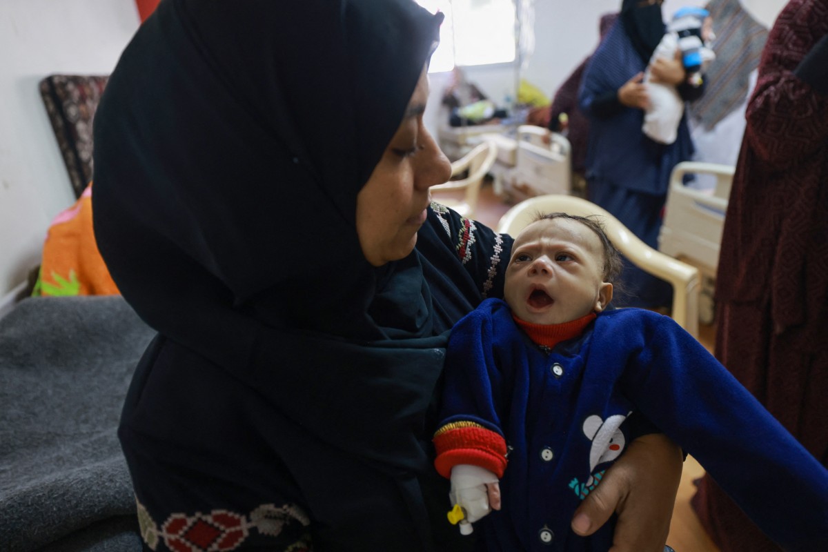 Des enfants palestiniens souffrant de malnutrition sont soignés dans un centre de santé à Rafah, dans le sud de la bande de Gaza, le 5 mars 2024, alors que la faim est généralisée dans le territoire palestinien assiégé en raison du conflit entre Israël et le groupe militant palestinien Hamas. (Photo Mohammed Abed AFP)
