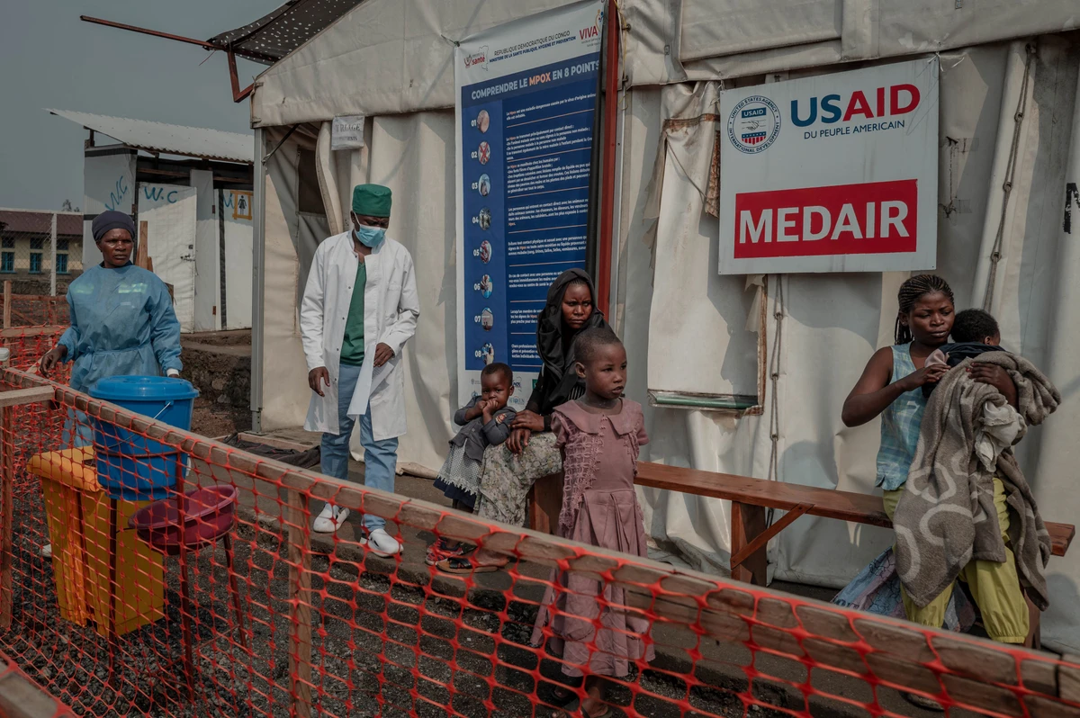 Mpox: le système de santé placé en « état de vigilance maximale » en France