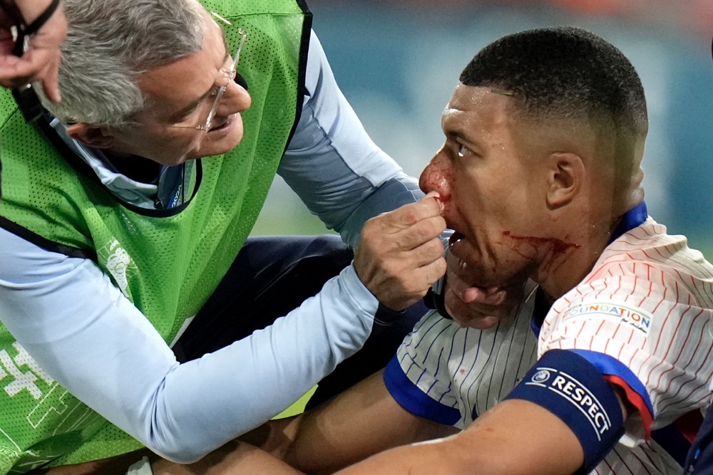 Kylian Mbappe of France receives a treatment after suffering an injury during a Group D match between Austria and France at the Euro 2024 soccer tournament in Duesseldorf, Germany. (AP)