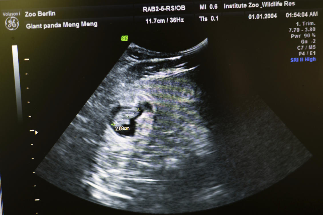 FILE -An embryo of a panda bear of pregnant panda Meng Meng is marked on the screen of an ultrasound machine at the panda enclosure at Berlin Zoo, Aug. 13, 2024. (AP)
